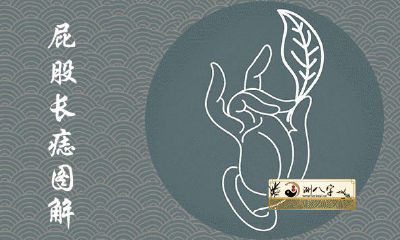 屁股不一样部位痣图解全集