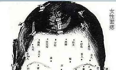 男女“痣”相精准分析