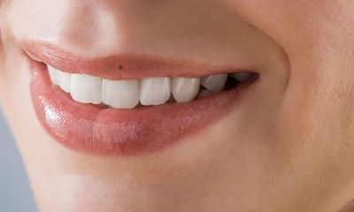 嘴唇上有痣怎么办，嘴唇周围的痣好吗？