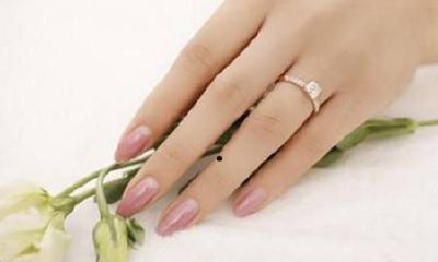 左手右手无名指有痣代表什么？