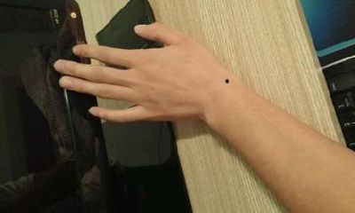 手腕有痣代表什么，手腕背面有痣好吗？