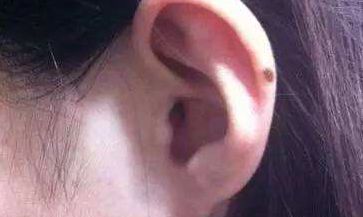 图解面部30种痣的位置与命运