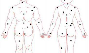 痣相算命图解【收藏吧，说不定以后会用到】