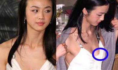 私处有痣好吗？私处有痣代表什么？