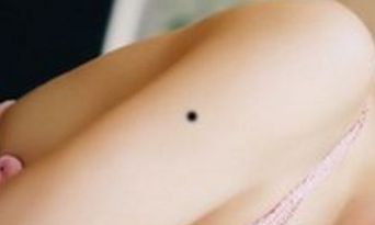 胳膊有痣的人，只会成功不会失败