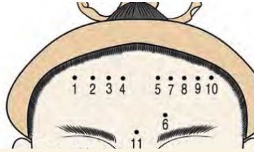 女人额头的十一颗痣相解析大全