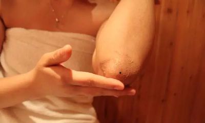 手肘外侧有痣代表什么