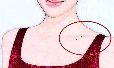 肩膀有痣的女人命好吗