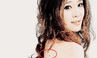 背的右上方有痣好不好 哪里长痣会开运