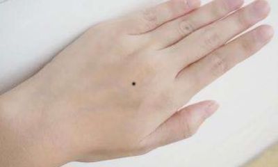 左手手背和左脚侧面有痣代表什么含义