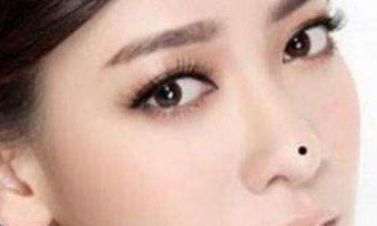 鼻翼右边长痣好不好