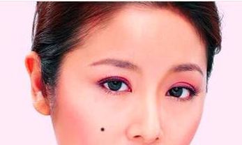 女人颧骨有痣好吗