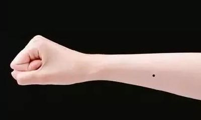 手臂上有痣是好不好