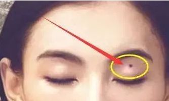 长什么痣相是劳碌命