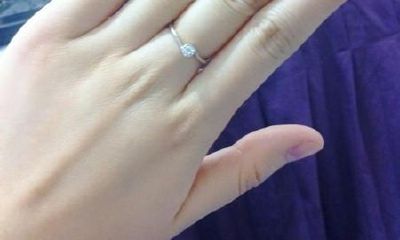 小拇指长痣的女人痣相解析