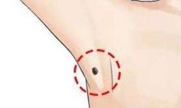 身上这几个部位有痣，千万不要点，是富贵痣