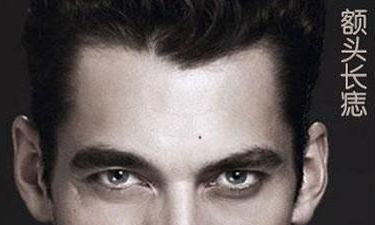 男人脸上哪些痣不能点