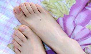 脚底有痣是人上人之相，脚上各部位痣相命理详解