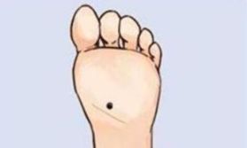 右脚脚底有痣是好的吗
