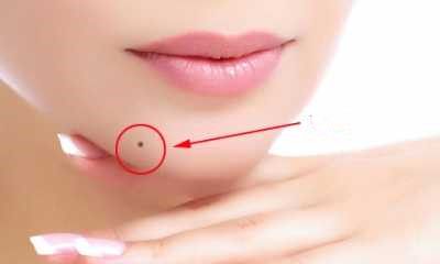 下巴有痣的寓意 不知道的赶紧看看