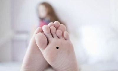 女人脚底板有痣属于天生富贵命？