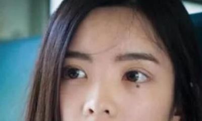 女生脸上这3种痣,都属于美人痣