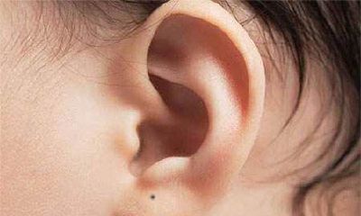 耳朵痣的位置与命运图解大全