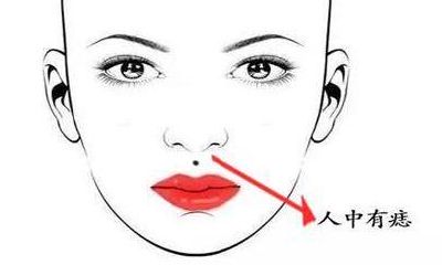 「人中痣」命运