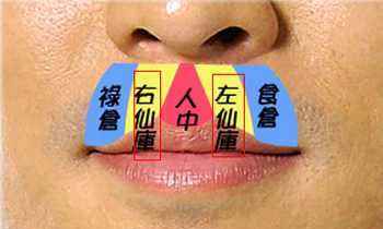 人中的中间有痣是生命大贵吗