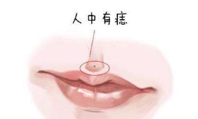 人中有痣的明星