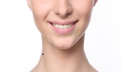 脖子上有痣代表什么，关于脖子上有痣的传说