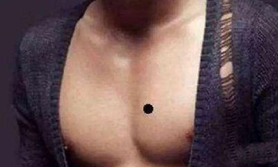 有狼心狗肺痣人缘一定差吗