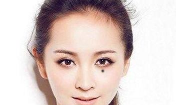 如何看面相痣位算命图解