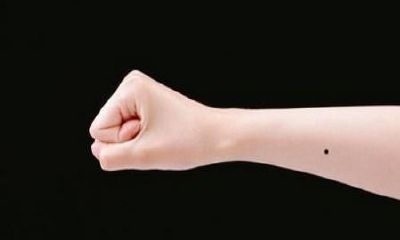 手臂上长痣代表什么 手臂痣相图解