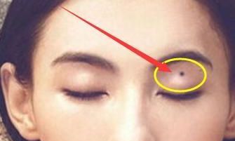 这几个位置有痣是富贵痣，男人痣相详解