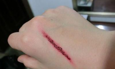 梦到自己从创口冒血