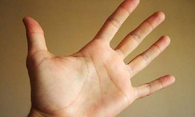 梦到手掌拔出虫子