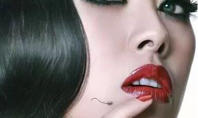 为什么痣上长毛，痣上长毛好不好？