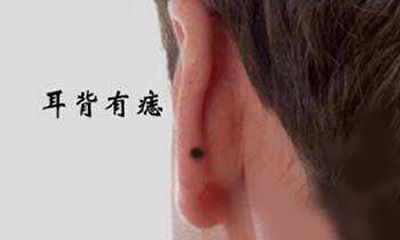 耳朵背后长痣面相图解