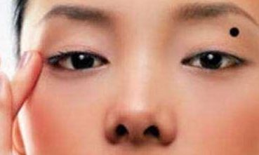 痣有好坏之分，身体这些部位长的都是「富贵痣」