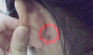 哪里长痣的女人最命好 哪里长痣不好