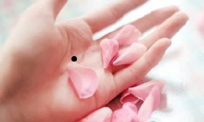 三种痣相的人注定横财不断