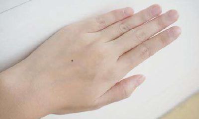 右手手背上长痣图解