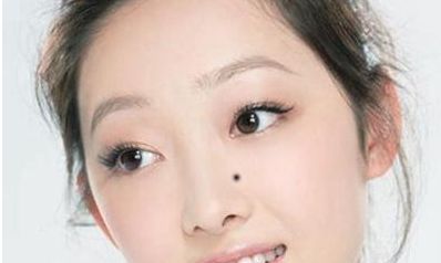 鼻翼两边长痣要注意