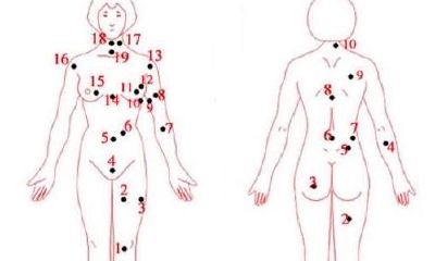 女人身上痣的位置与命运图分析