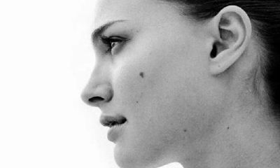 脸上痣的位置与命运解析