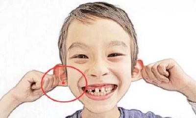 耳朵上长红痣代表什么