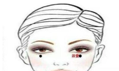 关于泪堂痣的相关研究