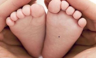 男童脚底心有痣意味着什么
