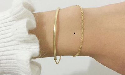 手掌其他部位痣解析